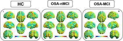 Abnormal cerebellar-prefrontal cortical pathways in obstructive sleep apnea with/without mild cognitive impairment